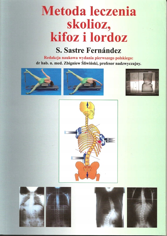 Metoda leczenia skolioz, kifoz i lordoz