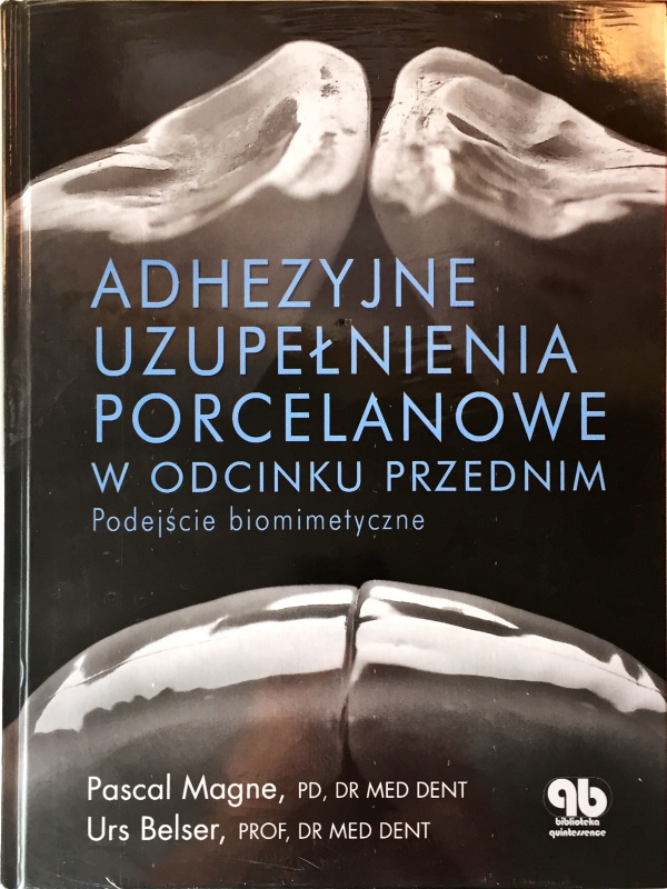 ADHEZYJNE UZUPEŁNIENIA PORCELANOWE - WYSYŁKA 0 ZŁ