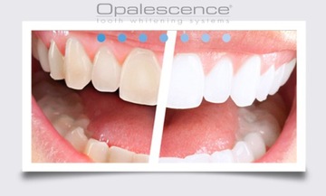 ОПАЛЕСЦЕНЦИЯ ОТБЕЛИВАЮЩАЯ ПАСТА - TEETH WHITE США