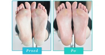 DELIA GOOD FOOT PODOLOGY - СЫВОРОТКА ДЛЯ ТРЕСКОВАННЫХ ПЯТОК