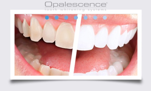 ОПАЛЕСЦЕНЦИЯ ОТБЕЛИВАЮЩАЯ ПАСТА - TEETH WHITE США